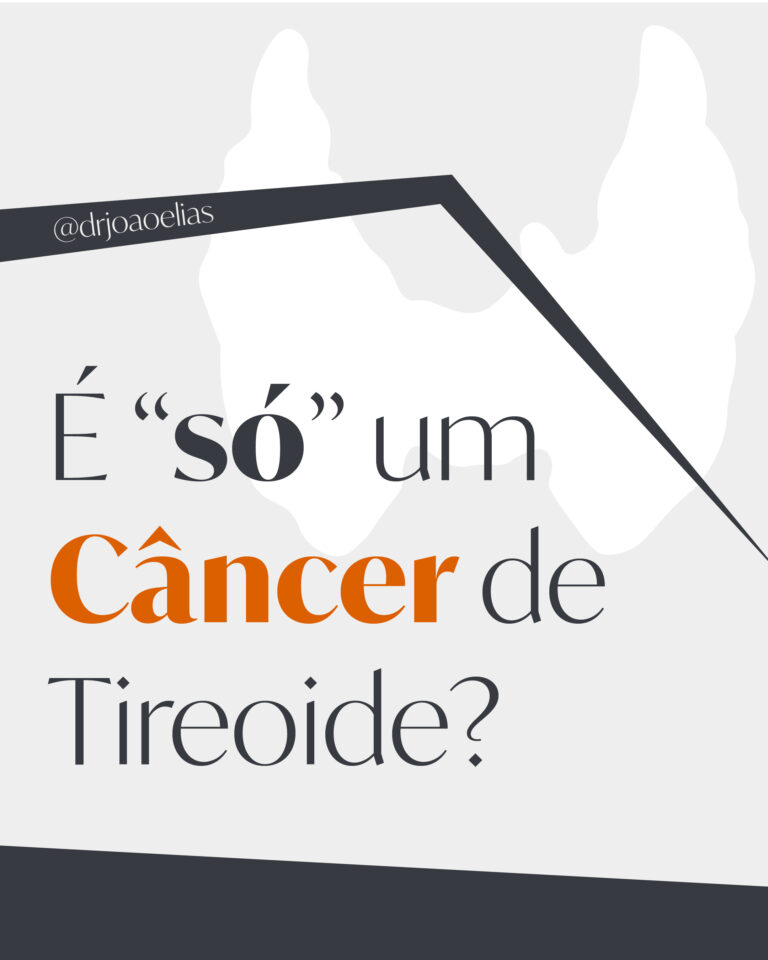 É só um Câncer de Tireoide?