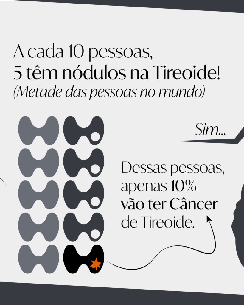 É só um Câncer de Tireoide?