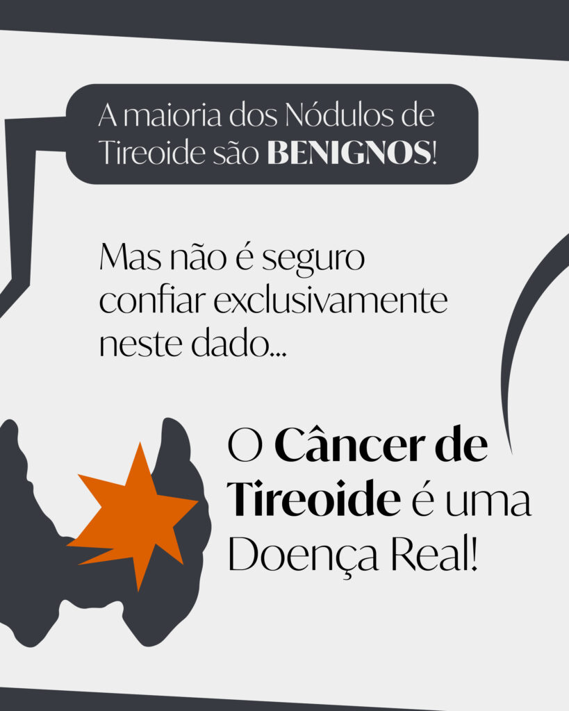 É só um Câncer de Tireoide?