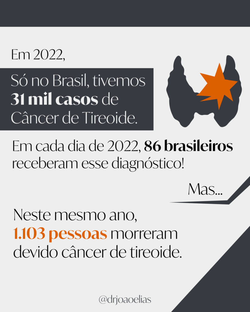 É só um Câncer de Tireoide?